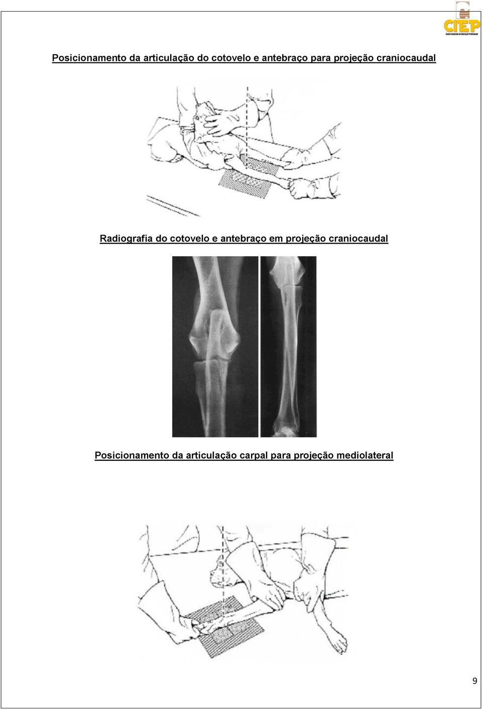 cotovelo e antebraço em projeção craniocaudal