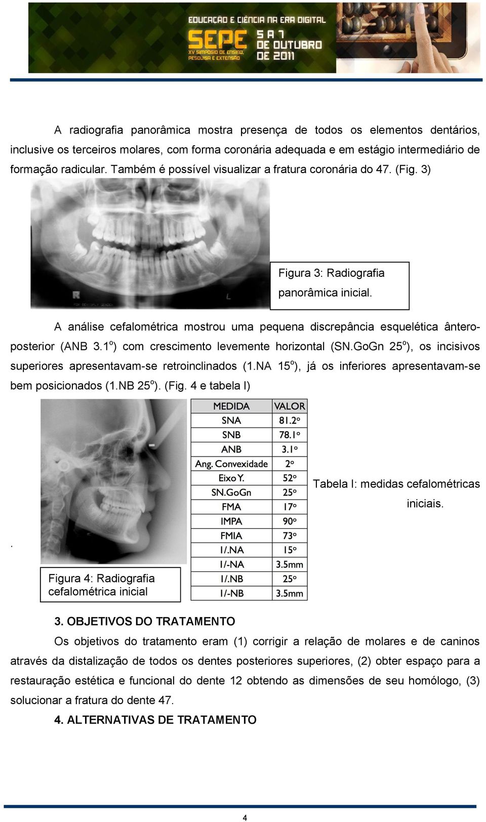 1 o ) com crescimento levemente horizontal (SN.GoGn 25 o ), os incisivos superiores apresentavam-se retroinclinados (1.NA 15 o ), já os inferiores apresentavam-se bem posicionados (1.NB 25 o ). (Fig.