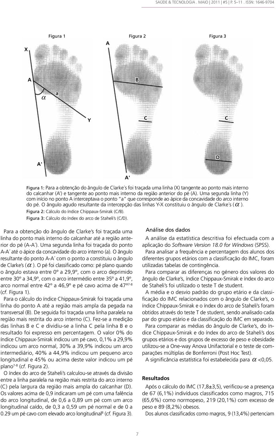 O ângulo agudo resultante da intercepção das linhas Y-X constituiu o ângulo de Clarke s (α ). Figura 2: Cálculo do índice Chippaux-Smirak (C/B). Figura 3: Cálculo do índex do arco de Staheli s (C/D).