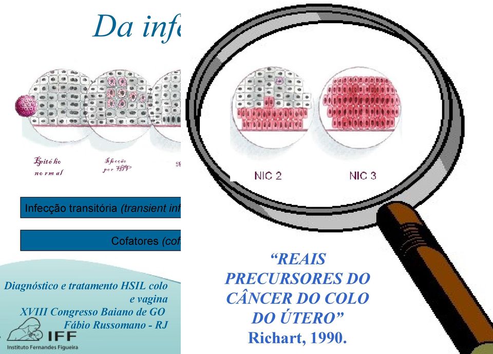 Progressão (progression) Cofatores (cofactors) Cânc e r d e c o lo