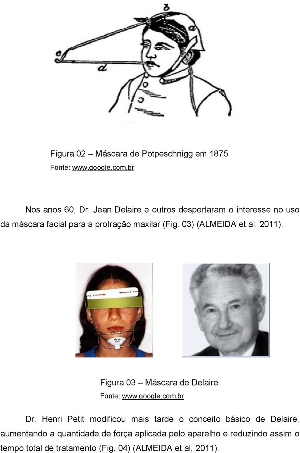 03) (ALMEIDA et al, 2011). Figura 03 Máscara de Delaire Fonte: www.google.com.br Dr.