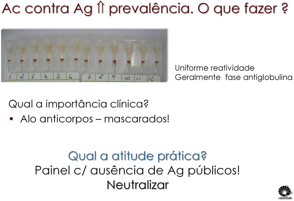 Qual a importância clínica? Alo anticorpos mascarados!