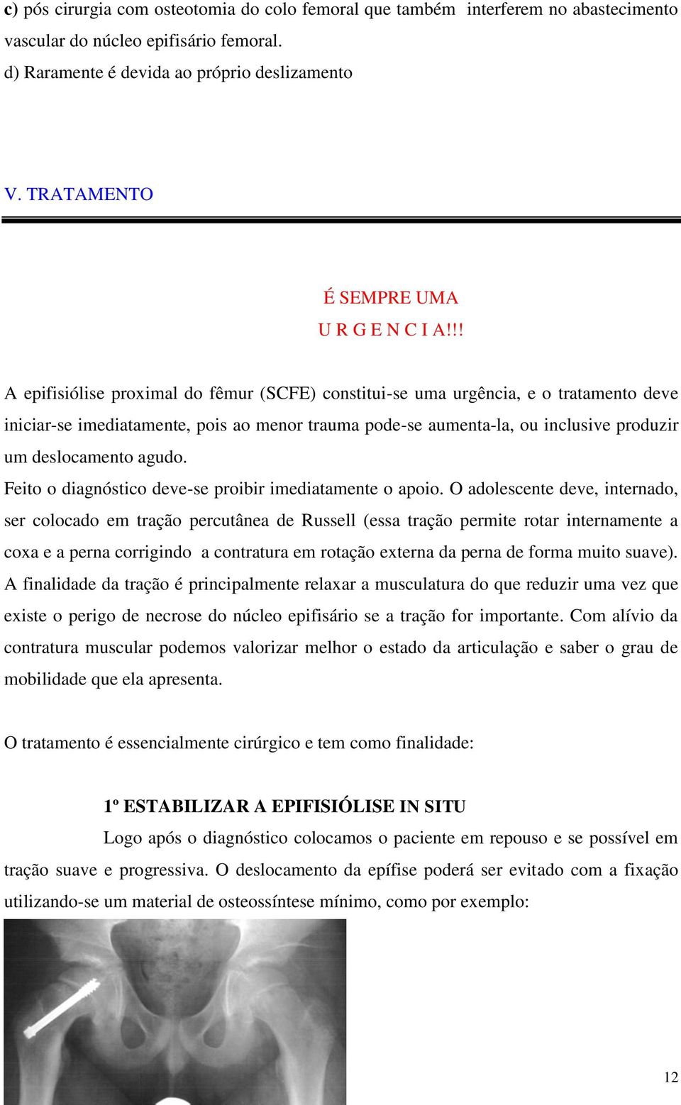 !! A epifisiólise proximal do fêmur (SCFE) constitui-se uma urgência, e o tratamento deve iniciar-se imediatamente, pois ao menor trauma pode-se aumenta-la, ou inclusive produzir um deslocamento agudo.