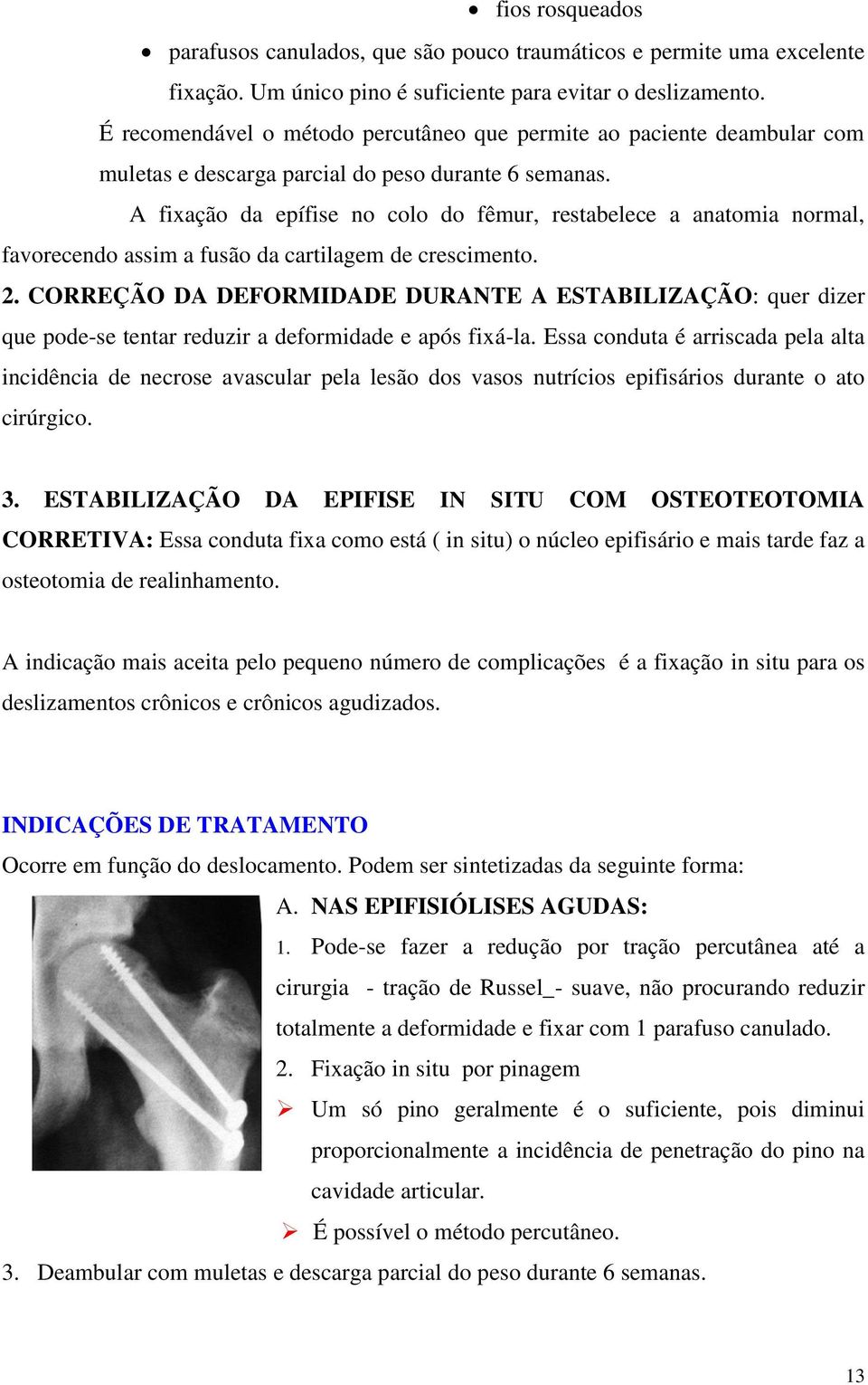 A fixação da epífise no colo do fêmur, restabelece a anatomia normal, favorecendo assim a fusão da cartilagem de crescimento. 2.