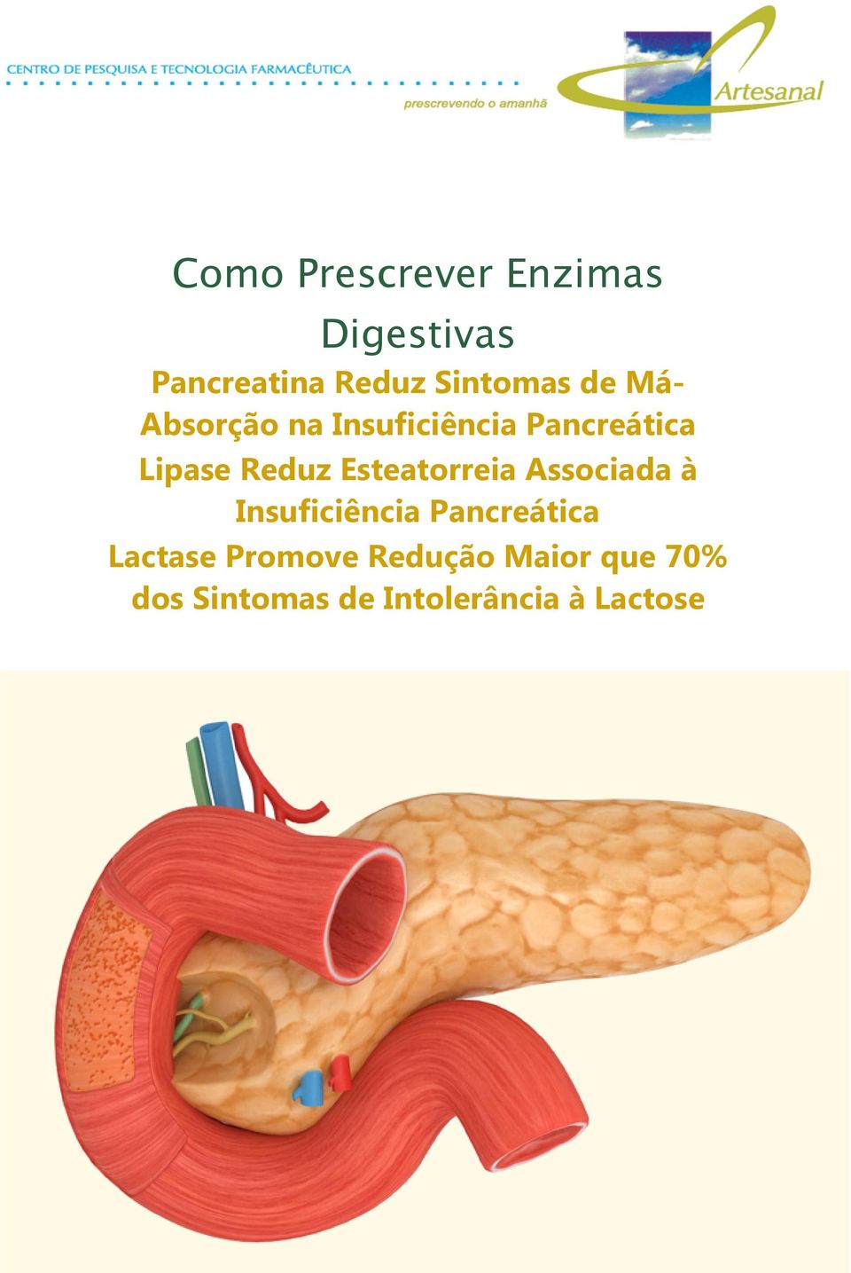 Esteatorreia Associada à Insuficiência Pancreática Lactase