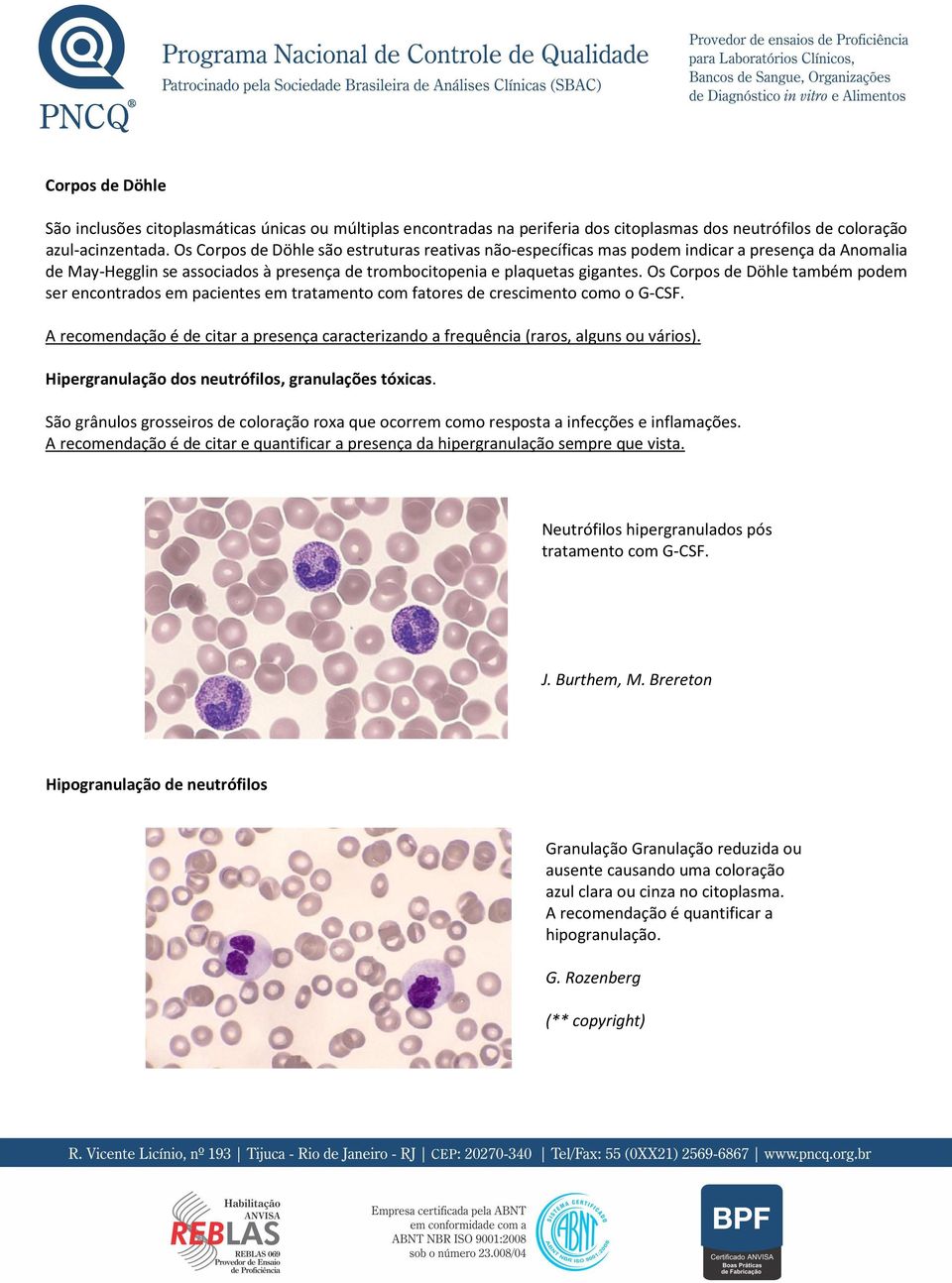 Os Corpos de Döhle também podem ser encontrados em pacientes em tratamento com fatores de crescimento como o G-CSF.