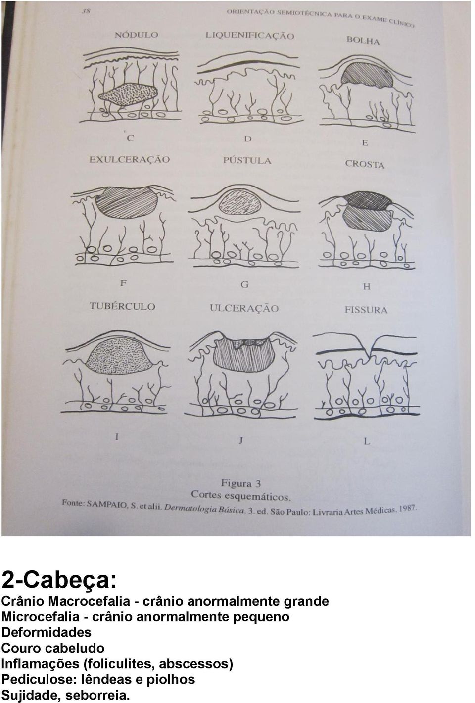 Deformidades Couro cabeludo Inflamações (foliculites,