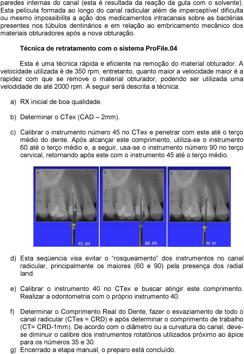 relação ao embricamento mecânico dos materiais obturadores após a nova obturação. Técnica de retratamento com o sistema ProFile.