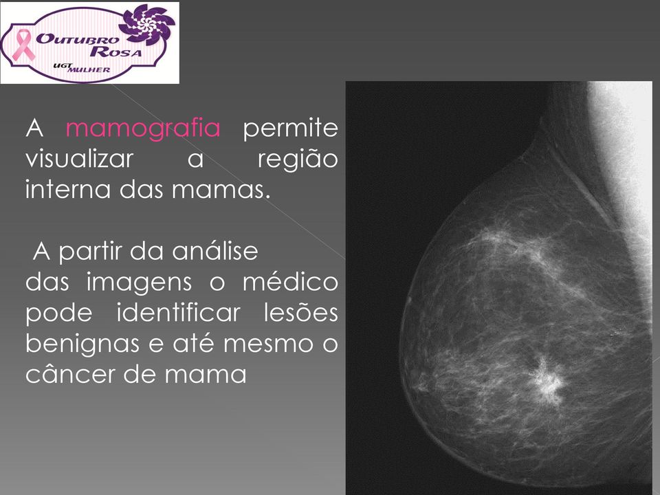 A partir da análise das imagens o médico