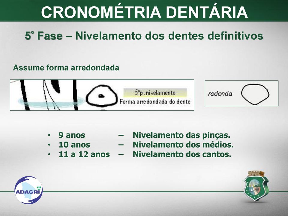 anos Nivelamento das pinças.