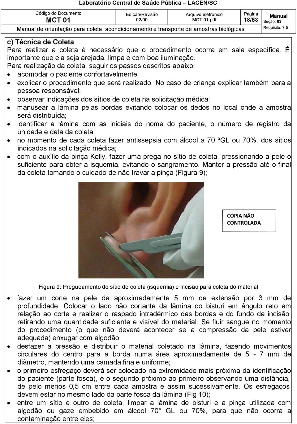 Para realização da coleta, seguir os passos descritos abaixo: acomodar o paciente confortavelmente; explicar o procedimento que será realizado.