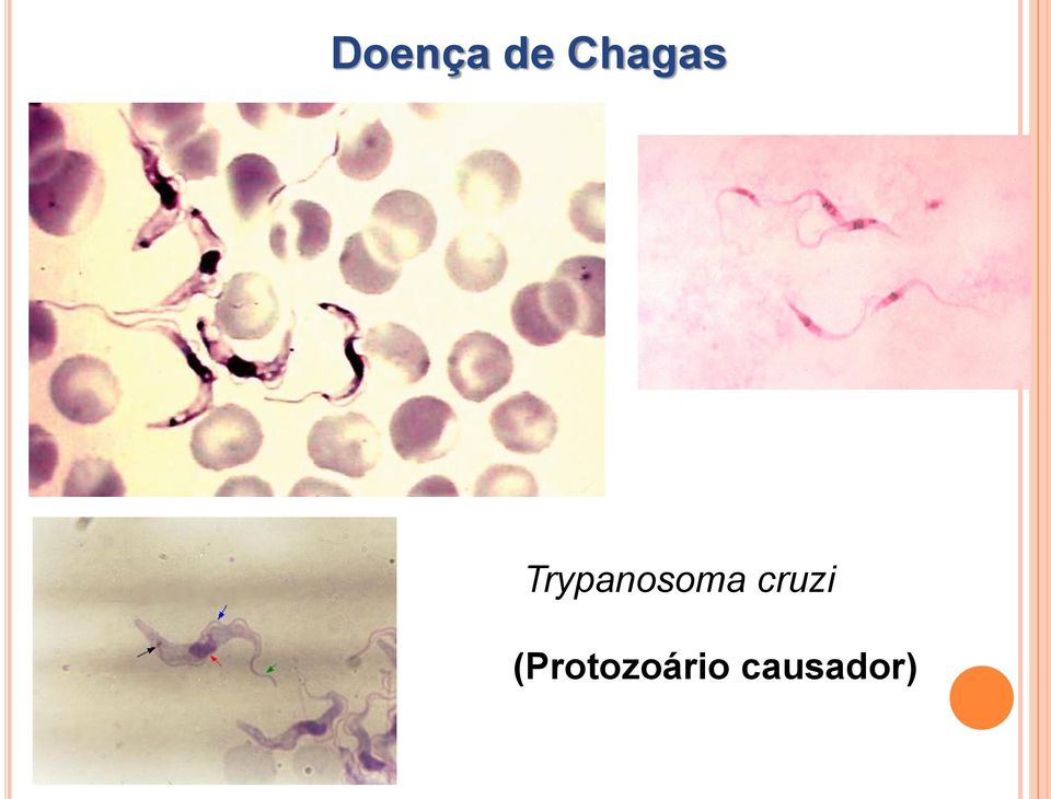 Trypanosoma