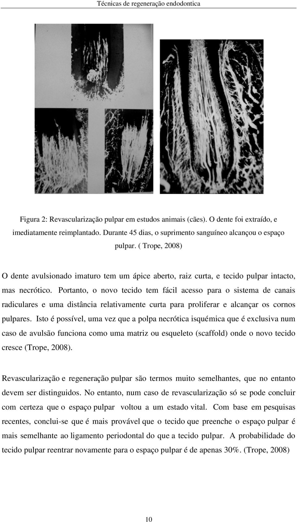 Portanto, o novo tecido tem fácil acesso para o sistema de canais radiculares e uma distância relativamente curta para proliferar e alcançar os cornos pulpares.