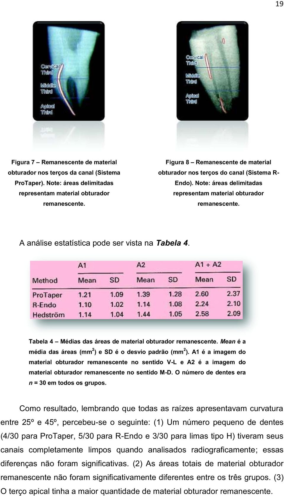 A análise estatística pode ser vista na Tabela 4. Tabela 4 Médias das áreas de material obturador remanescente. Mean é a média das áreas (mm 2 ) e SD é o desvio padrão (mm 2 ).