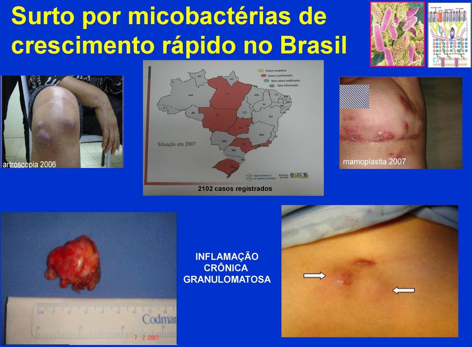 Brasil 2102 casos
