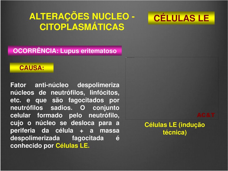 despolimeriza núcleos de neutrófilos, linfócitos, etc. e que são fagocitados por neutrófilos sadios.