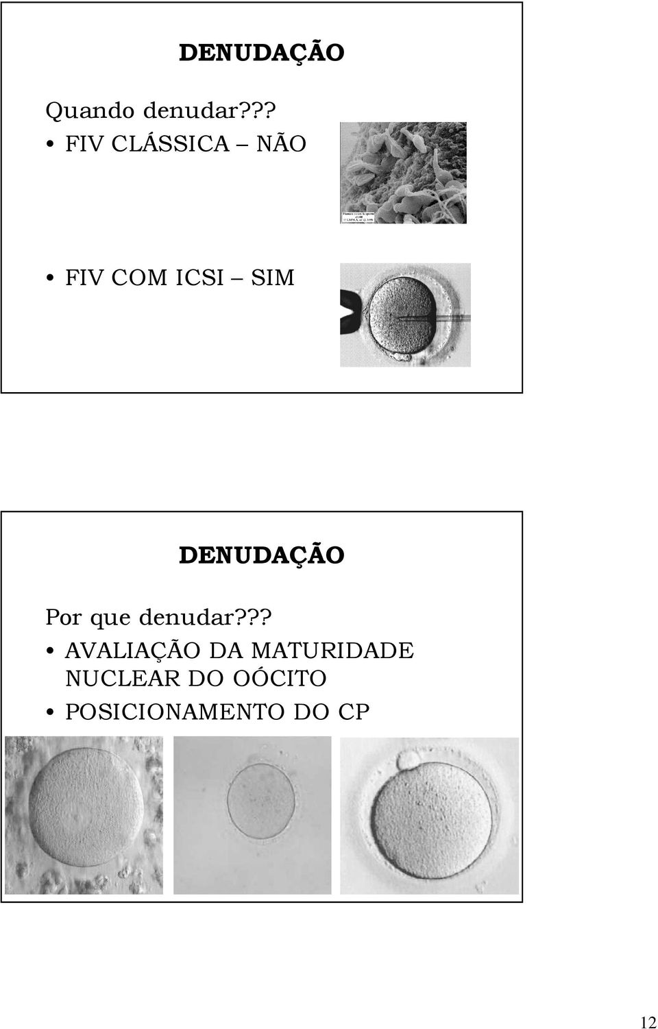 DENUDAÇÃO Por que denudar?