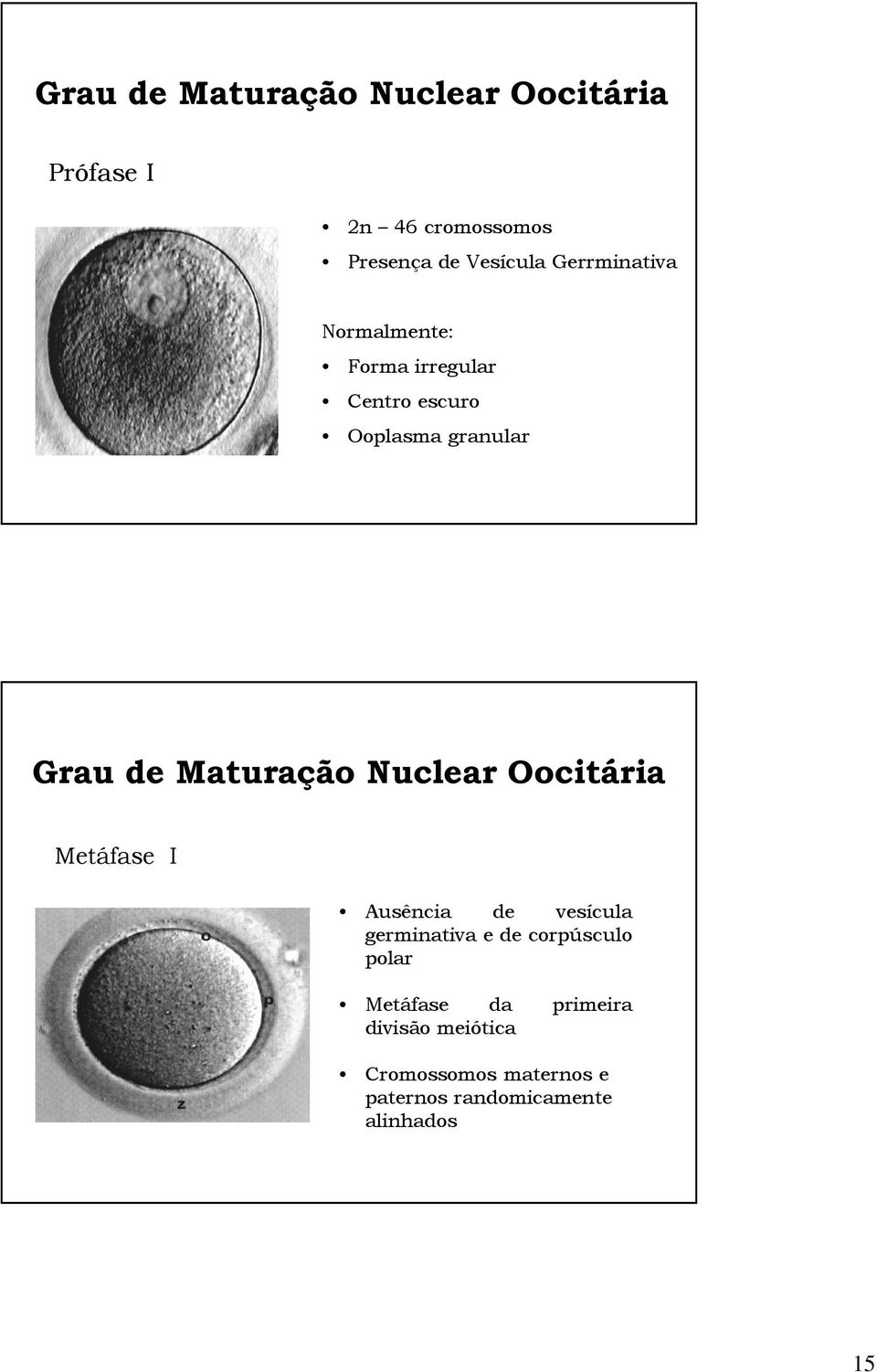Maturação Nuclear Oocitária Metáfase I Ausência de vesícula germinativa e de corpúsculo