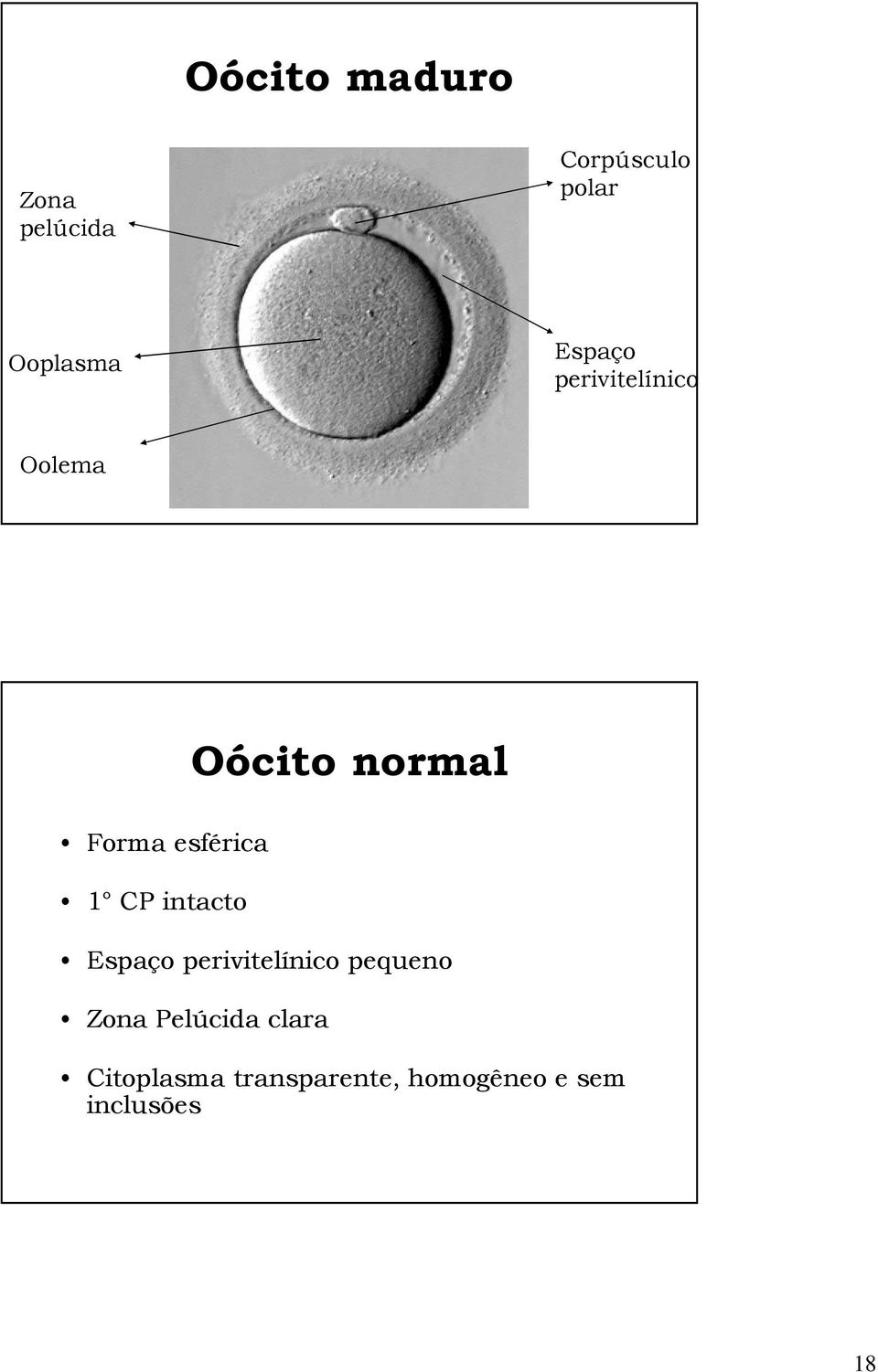 esférica 1 CP intacto Espaço perivitelínico pequeno Zona