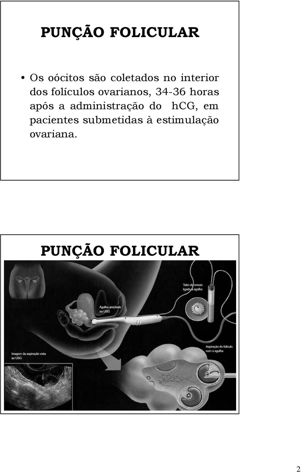 após a administração do hcg, em pacientes