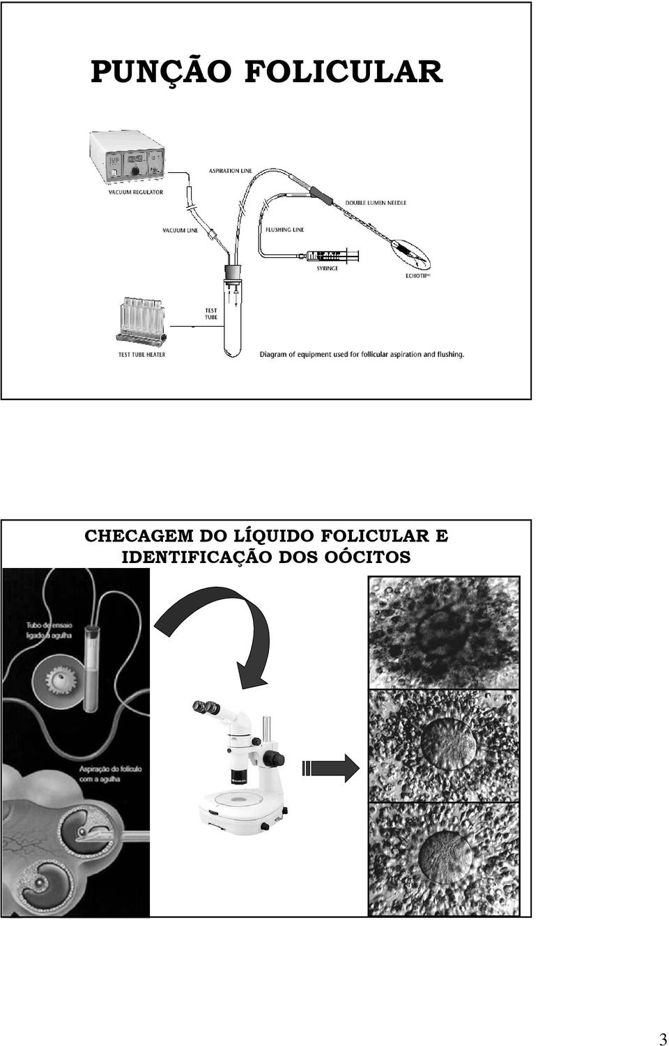 LÍQUIDO FOLICULAR