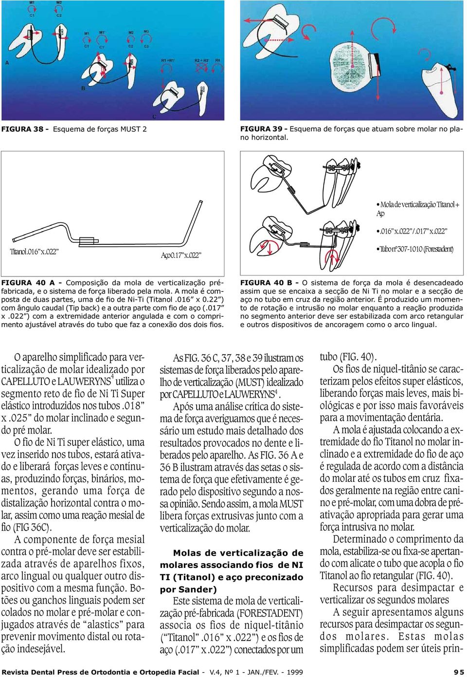 tubos.018 x.025 do molar inclinado e segundo pré molar.