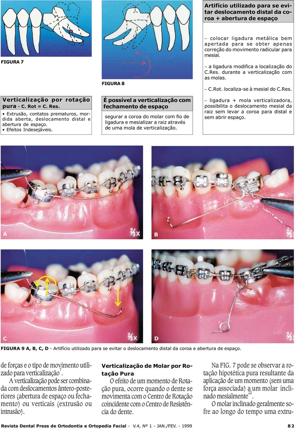 O efeito de um momento de Rotação pura, ocorre quando o dente se movimenta com o Centro de Rotação coincidente com o Centro de Resistência do