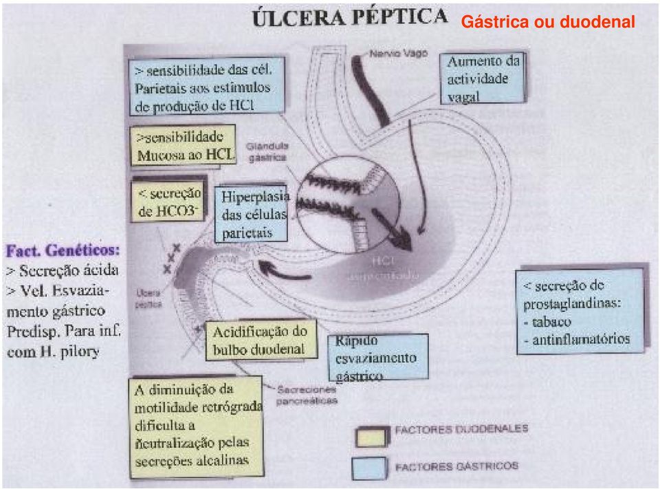 duodenal