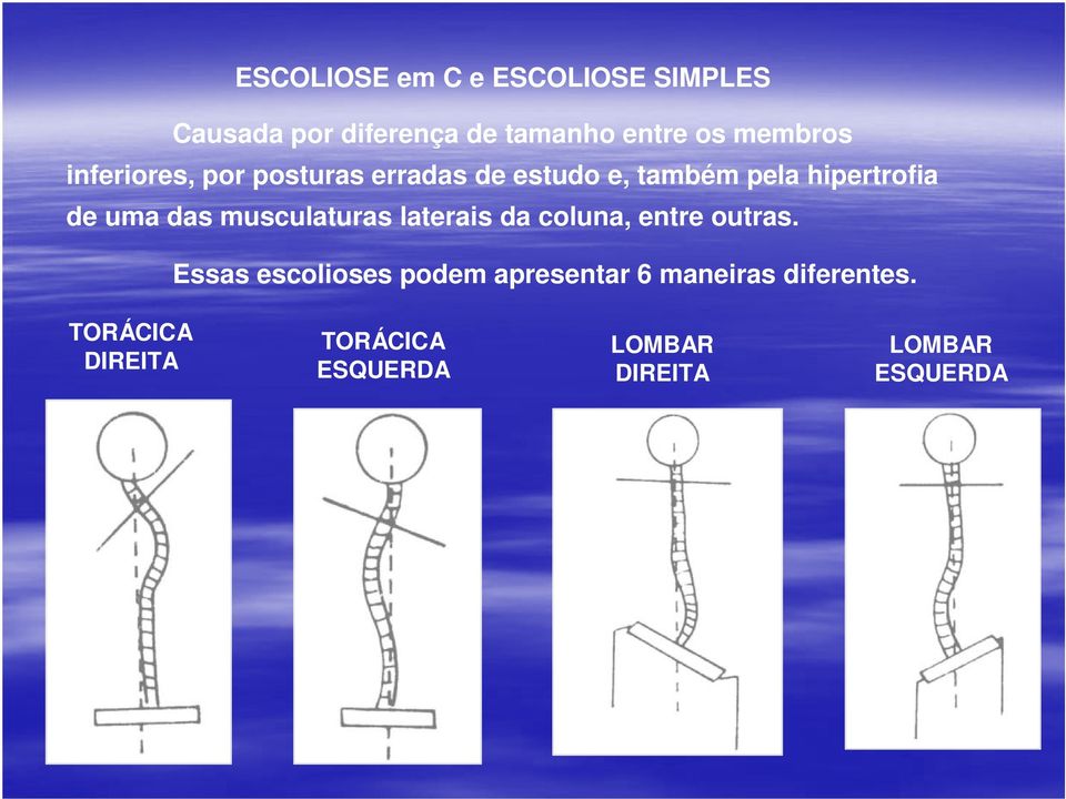 uma das musculaturas laterais da coluna, entre outras.