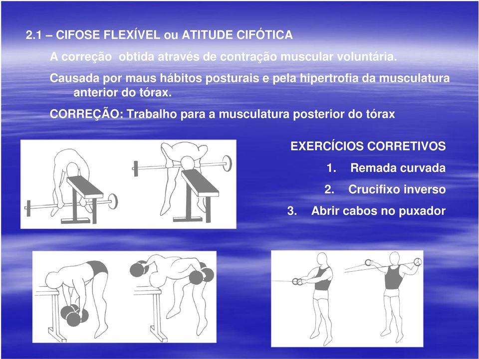 Causada por maus hábitos posturais e pela hipertrofia da musculatura anterior do