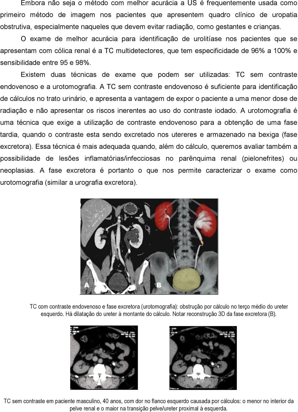 O exame de melhor acurácia para identificação de urolitíase nos pacientes que se apresentam com cólica renal é a TC multidetectores, que tem especificidade de 96% a 100% e sensibilidade entre 95 e