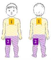 Anexo II - Banho com Toalhetes de GCH a 2%, em crianças Quadro 1 Técnica de banho com GCH 2% toalhetes para crianças (> 2 meses de idade corrigida), de acordo com o peso Número de