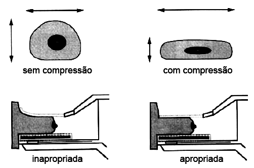 25 Figura 11: Sistema de compressão da mama. 2.2.3.1.4 Grade Antidifusora FONTE: CHRISTÓFOLI, Laura. 2000.