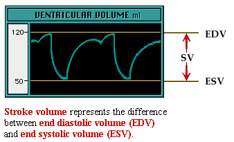 Volume Sistólico (VS) É o volume de sangue ejetado pelos ventrículos a cada batimento. É a diferença entre o VDF e o VSF. É também conhecido como Volume de Ejeção.