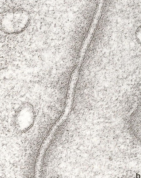 Zonula adherens: Formam uma espécie de cinto em torno das células, que as repuxa (zona luminal/apical) Aparecem em