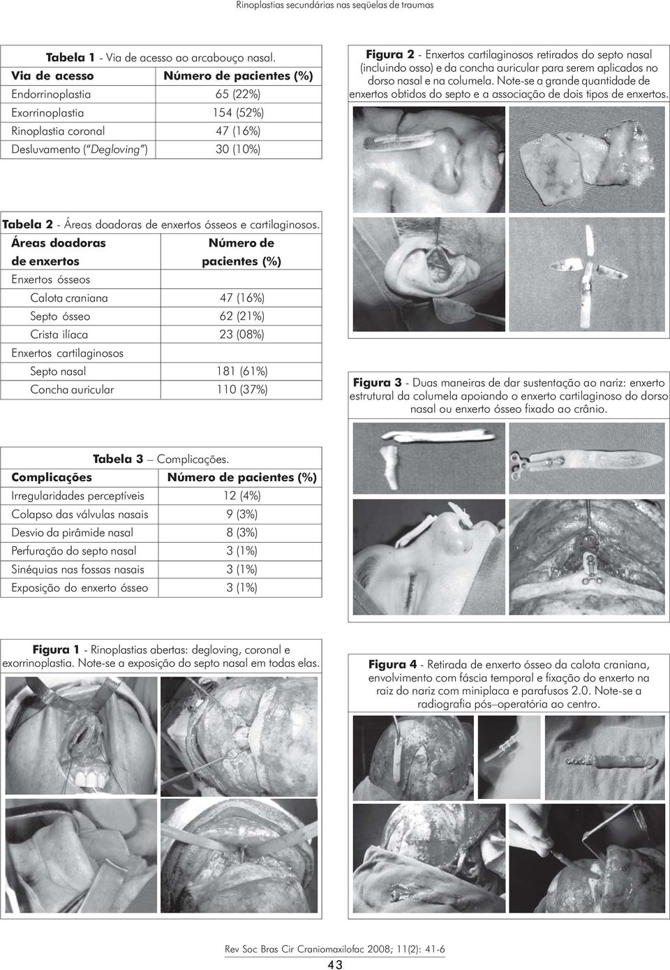 do septo nasal (incluindo osso) e da concha auricular para serem aplicados no dorso nasal e na columela.