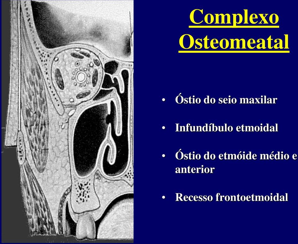 etmoidal Óstio do etmóide