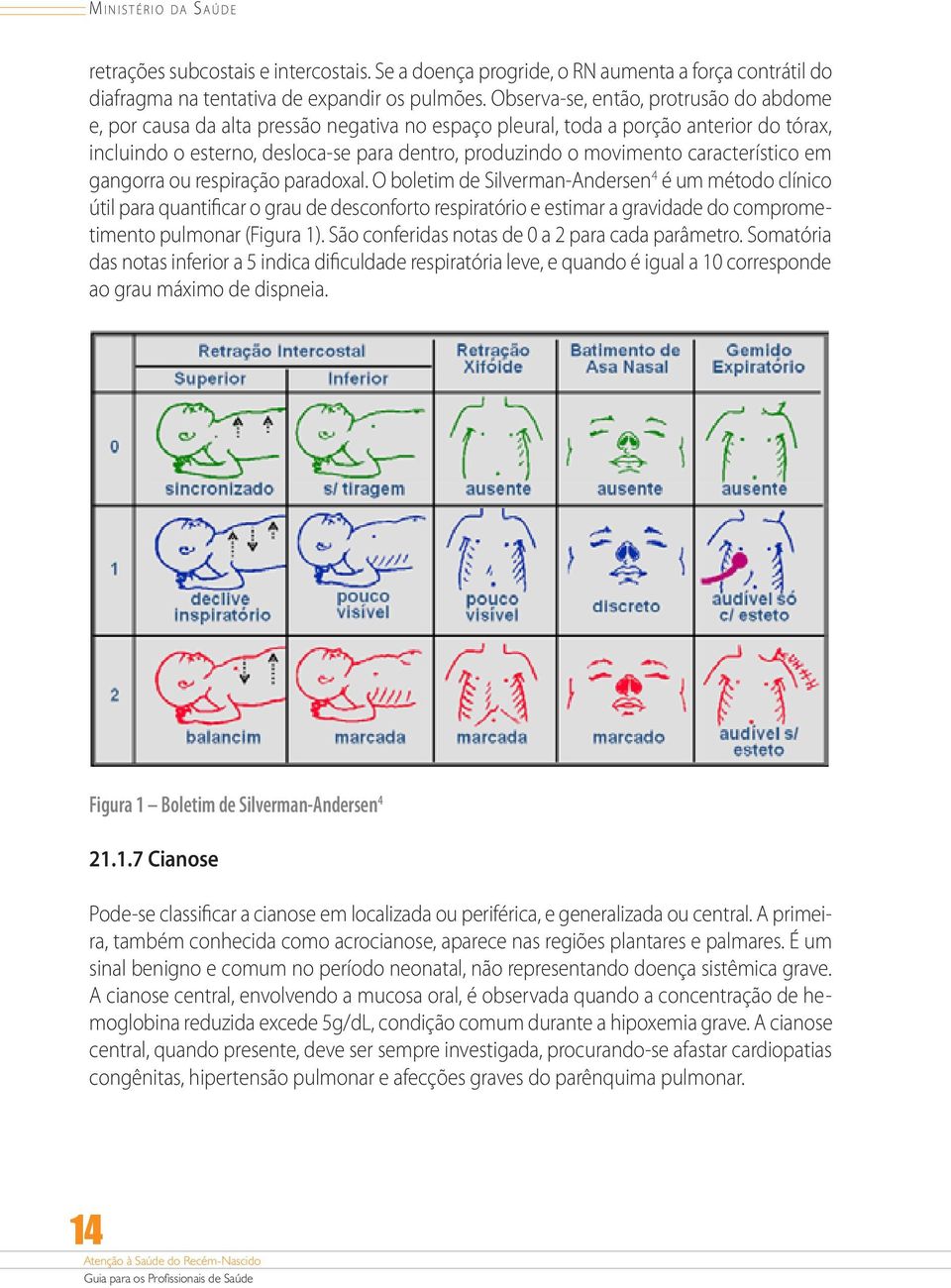 característico em gangorra ou respiração paradoxal.