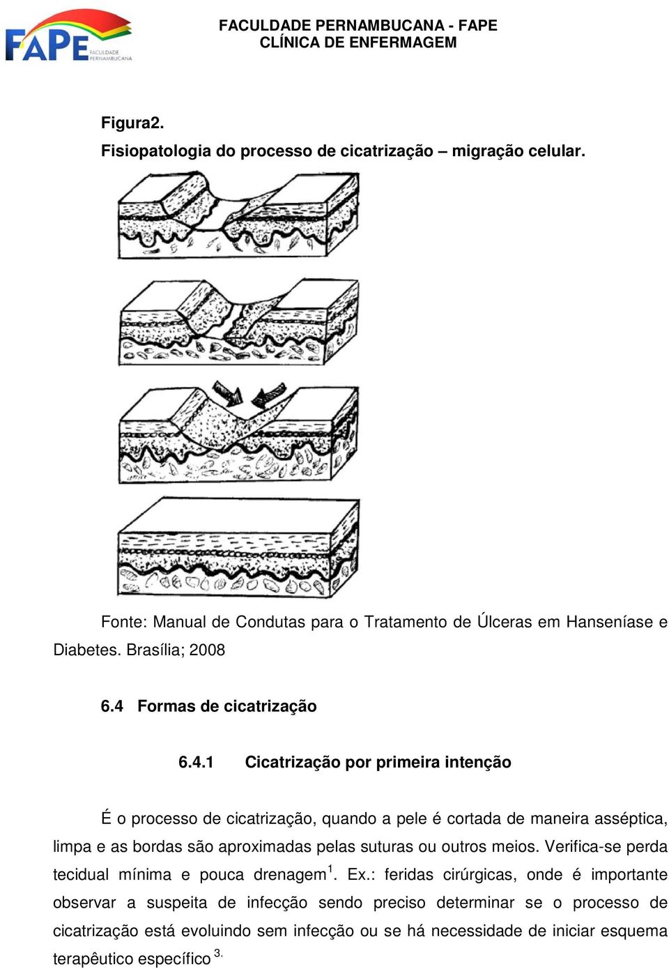 Formas de cicatrização 6.4.