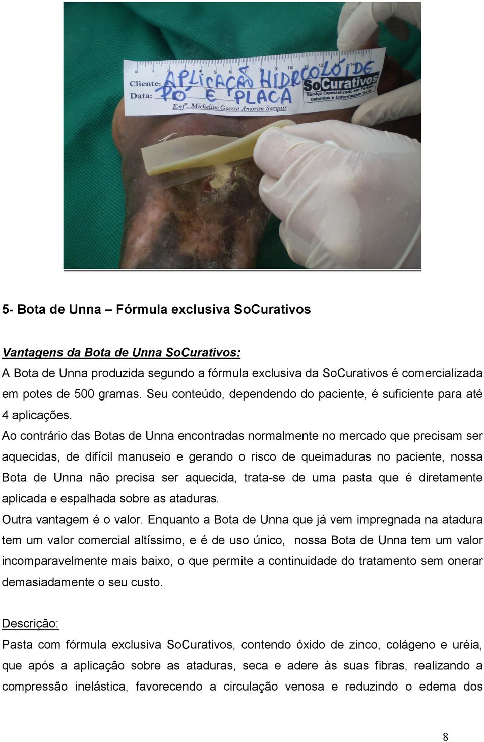 Ao contrário das Botas de Unna encontradas normalmente no mercado que precisam ser aquecidas, de difícil manuseio e gerando o risco de queimaduras no paciente, nossa Bota de Unna não precisa ser