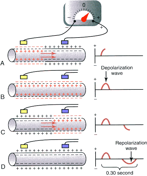 A variação da d.d.p. numa fibra muscular A figura mostra uma única fibra muscular em diferentes estádios de despolarização e repolarização. A d.d.p entre as duas extremidades da fibra encontra-se a ser medida por um electrocardiógrafo.