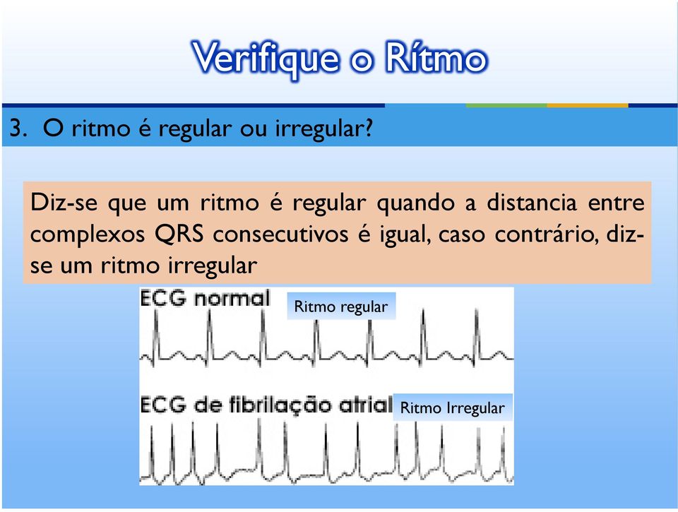 entre complexos QRS consecutivos é igual, caso