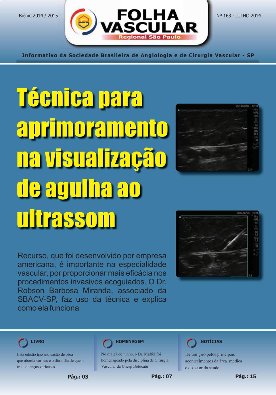 O Dr. Robson Barbosa Miranda, associado da SBACV-SP, faz uso da técnica e explica como ela funciona LIVRO Esta edição traz indicação de obra que aborda varizes e o dia a dia de quem trata doenças