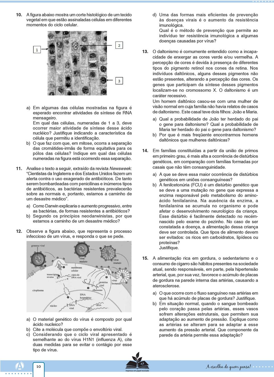 Em qual das células, numeradas de 1 a 3, deve ocorrer maior atividade de síntese desse ácido nucléico? Justifique indicando a característica da célula que permitiu a identificação.