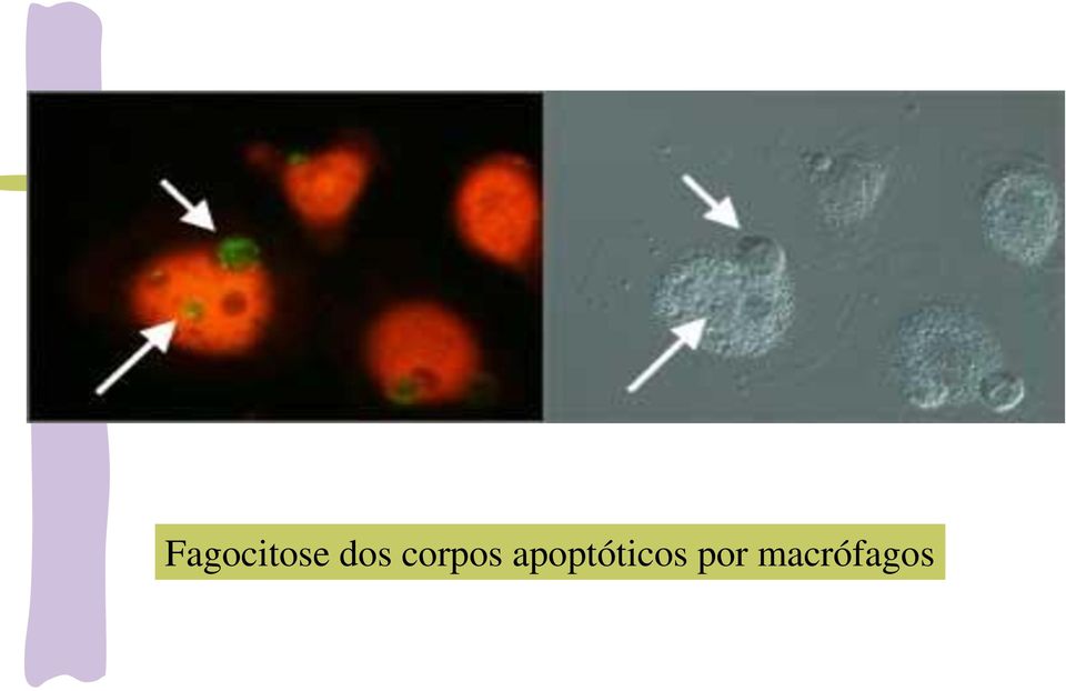 apoptóticos