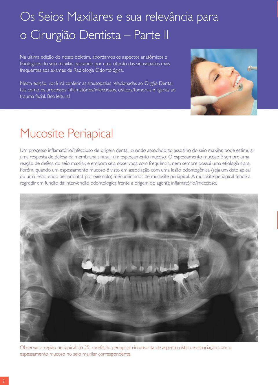 Nesta edição, você irá conferir as sinusopatias relacionadas ao Órgão Dental, tais como os processos inflamatórios/infecciosos, císticos/tumorais e ligadas ao trauma facial. Boa leitura!