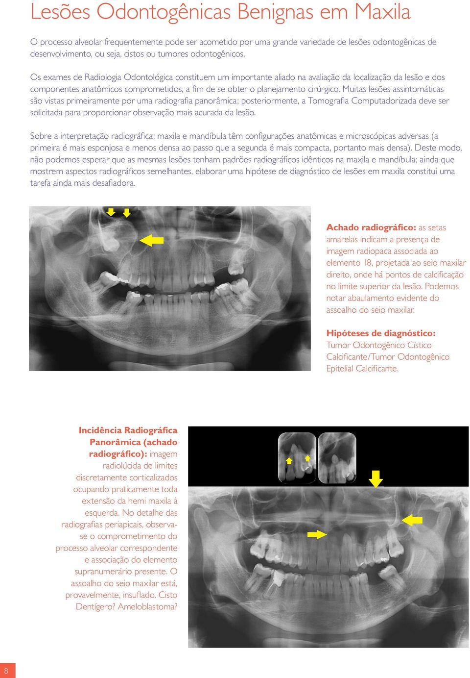 Os exames de Radiologia Odontológica constituem um importante aliado na avaliação da localização da lesão e dos componentes anatômicos comprometidos, a fim de se obter o planejamento cirúrgico.