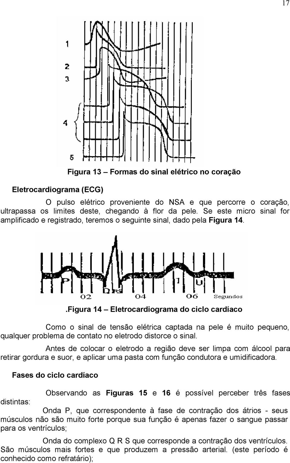 .Figura 14 Eletrocardiograma do ciclo cardíaco Como o sinal de tensão elétrica captada na pele é muito pequeno, qualquer problema de contato no eletrodo distorce o sinal.