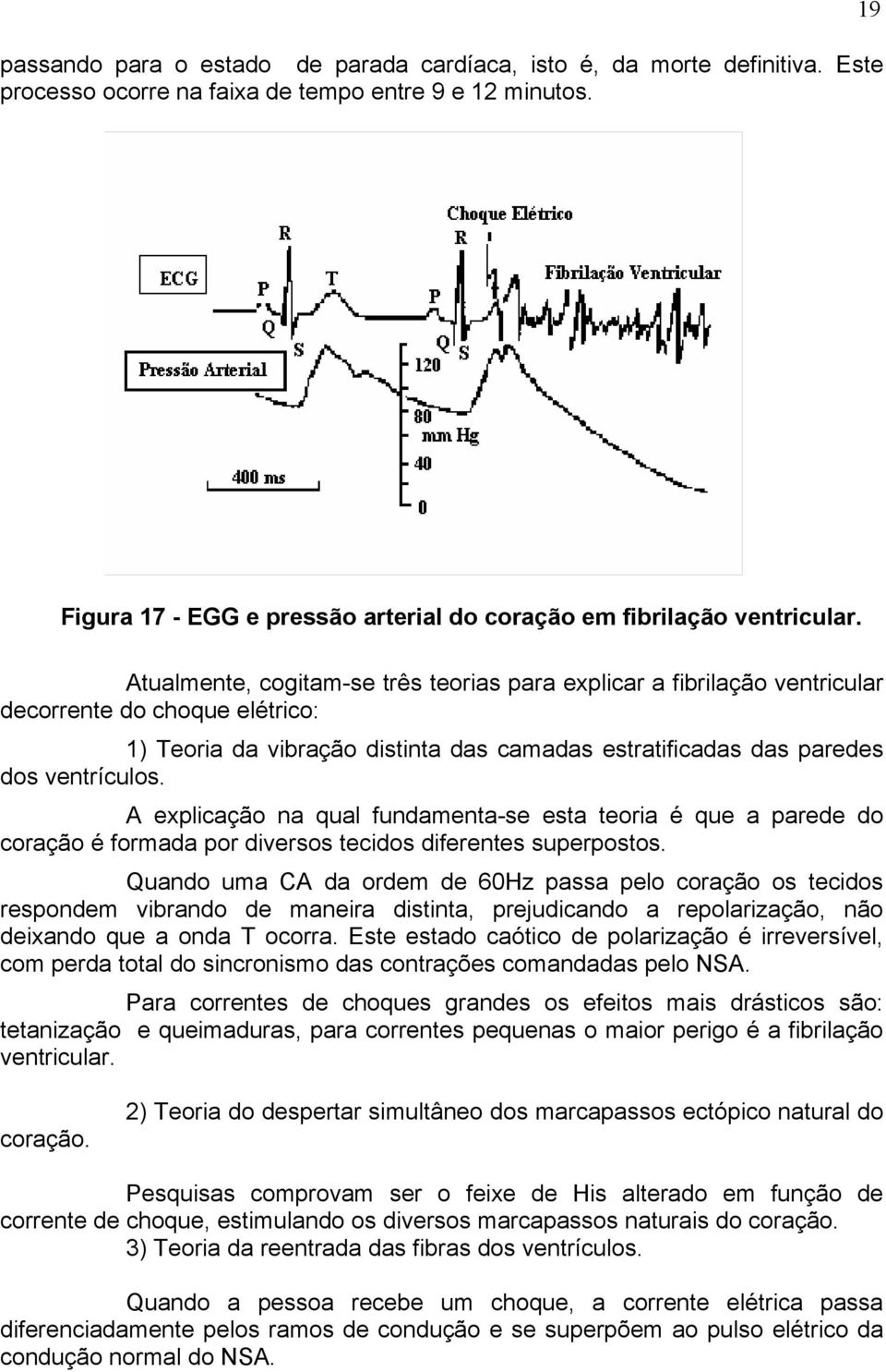 Atualmente, cogitam-se três teorias para explicar a fibrilação ventricular decorrente do choque elétrico: 1) Teoria da vibração distinta das camadas estratificadas das paredes dos ventrículos.