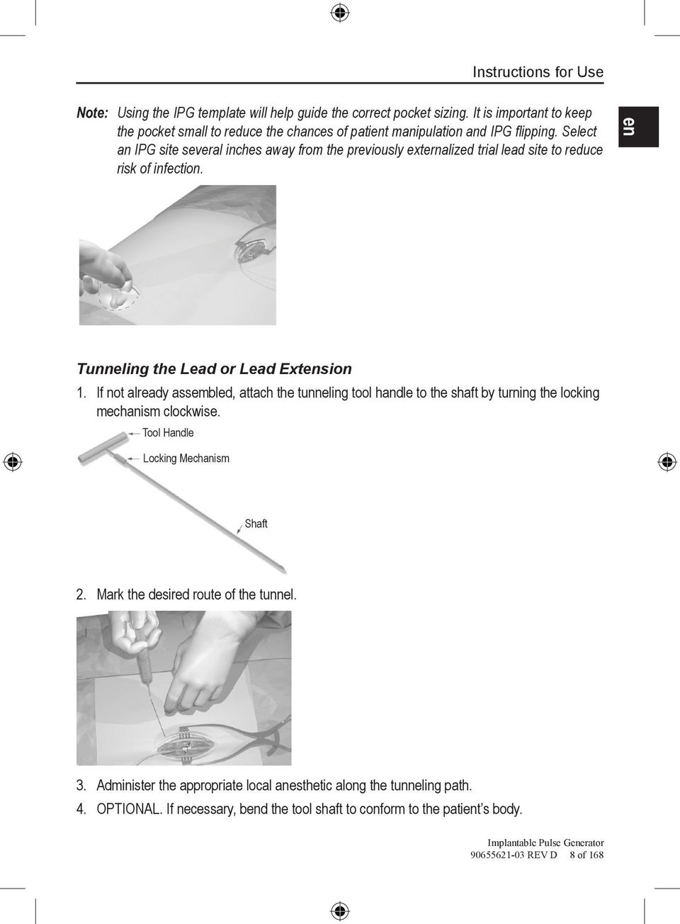 Select an IPG site several inches away from the previously externalized trial lead site to reduce risk of infection. en Tunneling the Lead or Lead Extension 1.